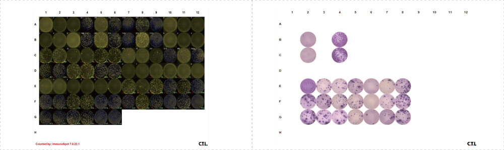 Data-shown-was-EliSpot-FluoroSpot-PBMC.jpg Data-shown-was-EliSpot-FluoroSpot-PBMC.jpg